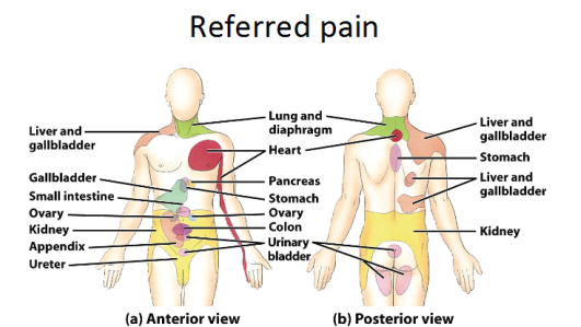 Where Is My Pain Really From?